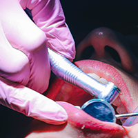 Evita las caries con estos consejos